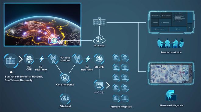 智能诊断新纪元 AI宫颈癌筛查系统为病理医师赋能